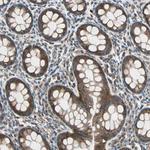 MLK4 Antibody in Immunohistochemistry (Paraffin) (IHC (P))