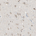 MLK4 Antibody in Immunohistochemistry (Paraffin) (IHC (P))