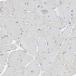 MLK4 Antibody in Immunohistochemistry (Paraffin) (IHC (P))