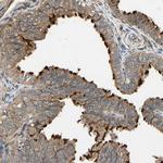 MGRN1 Antibody in Immunohistochemistry (Paraffin) (IHC (P))