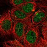 CaMKV Polyclonal Antibody