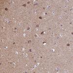 CaMKV Antibody in Immunohistochemistry (Paraffin) (IHC (P))