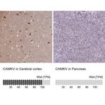 CaMKV Antibody in Immunohistochemistry (IHC)