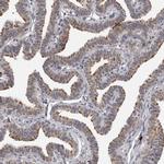 CDK20 Antibody in Immunohistochemistry (IHC)