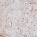 CDK20 Antibody in Immunohistochemistry (IHC)