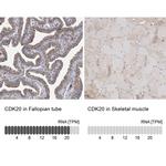 CDK20 Antibody