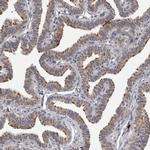 CDK20 Polyclonal Antibody