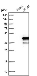 CDK20 Antibody in Western Blot (WB)