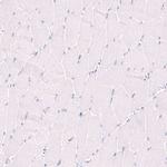 SAPK4 Antibody in Immunohistochemistry (Paraffin) (IHC (P))