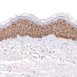 SAPK4 Antibody in Immunohistochemistry (Paraffin) (IHC (P))