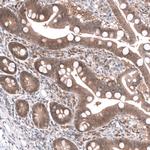 SAPK4 Antibody in Immunohistochemistry (Paraffin) (IHC (P))
