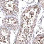 SAPK4 Antibody in Immunohistochemistry (Paraffin) (IHC (P))
