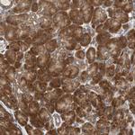 AUP1 Antibody in Immunohistochemistry (Paraffin) (IHC (P))