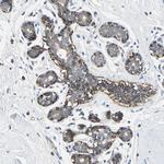 NIM1 Polyclonal Antibody