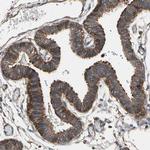 CCP2 Antibody in Immunohistochemistry (Paraffin) (IHC (P))