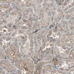 CCP2 Antibody in Immunohistochemistry (Paraffin) (IHC (P))