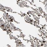 CCP2 Antibody in Immunohistochemistry (Paraffin) (IHC (P))