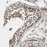 CCP2 Polyclonal Antibody