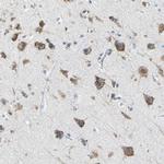 PLCXD1 Antibody in Immunohistochemistry (Paraffin) (IHC (P))