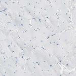 PLCXD1 Antibody in Immunohistochemistry (Paraffin) (IHC (P))