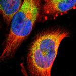 FNDC3B Polyclonal Antibody