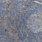 FNDC3B Antibody in Immunohistochemistry (Paraffin) (IHC (P))