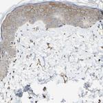 FNDC3B Antibody in Immunohistochemistry (Paraffin) (IHC (P))