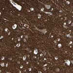 SV2A Antibody in Immunohistochemistry (IHC)