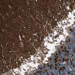 SV2A Antibody in Immunohistochemistry (IHC)