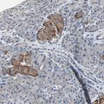 SV2A Antibody in Immunohistochemistry (IHC)