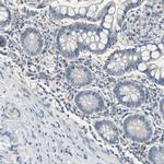 SV2A Antibody in Immunohistochemistry (IHC)
