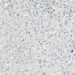Brevican Antibody in Immunohistochemistry (Paraffin) (IHC (P))