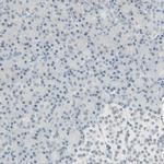 Brevican Polyclonal Antibody