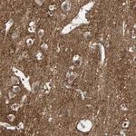 Brevican Antibody in Immunohistochemistry (IHC)