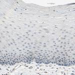 ABCA3 Antibody in Immunohistochemistry (Paraffin) (IHC (P))