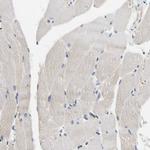 CECR1 Antibody in Immunohistochemistry (Paraffin) (IHC (P))