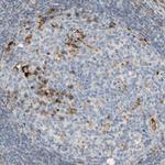 CECR1 Antibody in Immunohistochemistry (Paraffin) (IHC (P))