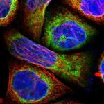 LPCAT2 Polyclonal Antibody