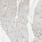 LPCAT2 Antibody in Immunohistochemistry (Paraffin) (IHC (P))