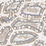 LPCAT2 Antibody in Immunohistochemistry (Paraffin) (IHC (P))