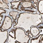 LPCAT2 Antibody in Immunohistochemistry (Paraffin) (IHC (P))