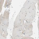 LPCAT2 Antibody in Immunohistochemistry (IHC)