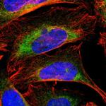 CYB5B Polyclonal Antibody