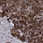 CYB5B Antibody in Immunohistochemistry (Paraffin) (IHC (P))
