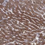 CYB5B Antibody in Immunohistochemistry (Paraffin) (IHC (P))