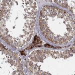 CYB5B Antibody in Immunohistochemistry (Paraffin) (IHC (P))