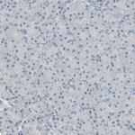 P4HA3 Antibody in Immunohistochemistry (Paraffin) (IHC (P))