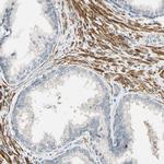 P4HA3 Antibody in Immunohistochemistry (Paraffin) (IHC (P))