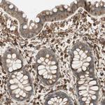 BTN3A3 Antibody in Immunohistochemistry (Paraffin) (IHC (P))