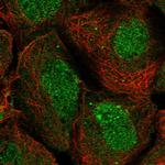 ISYNA1 Polyclonal Antibody